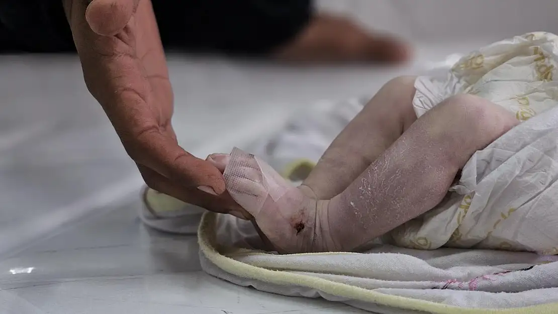 Gazze'de Açlık Felaketi: Son 24 Saatte 5 Kişi Daha Hayatını Kaybetti