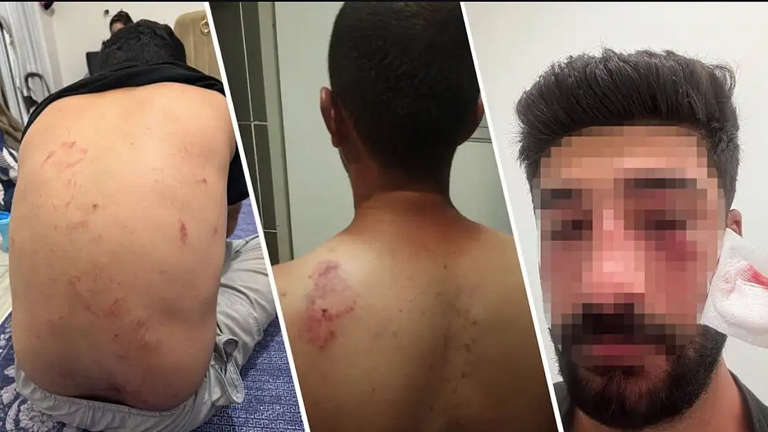 Mersin'de Kürtçe Konuştukları Gerekçesiyle Saldırı İddiası
