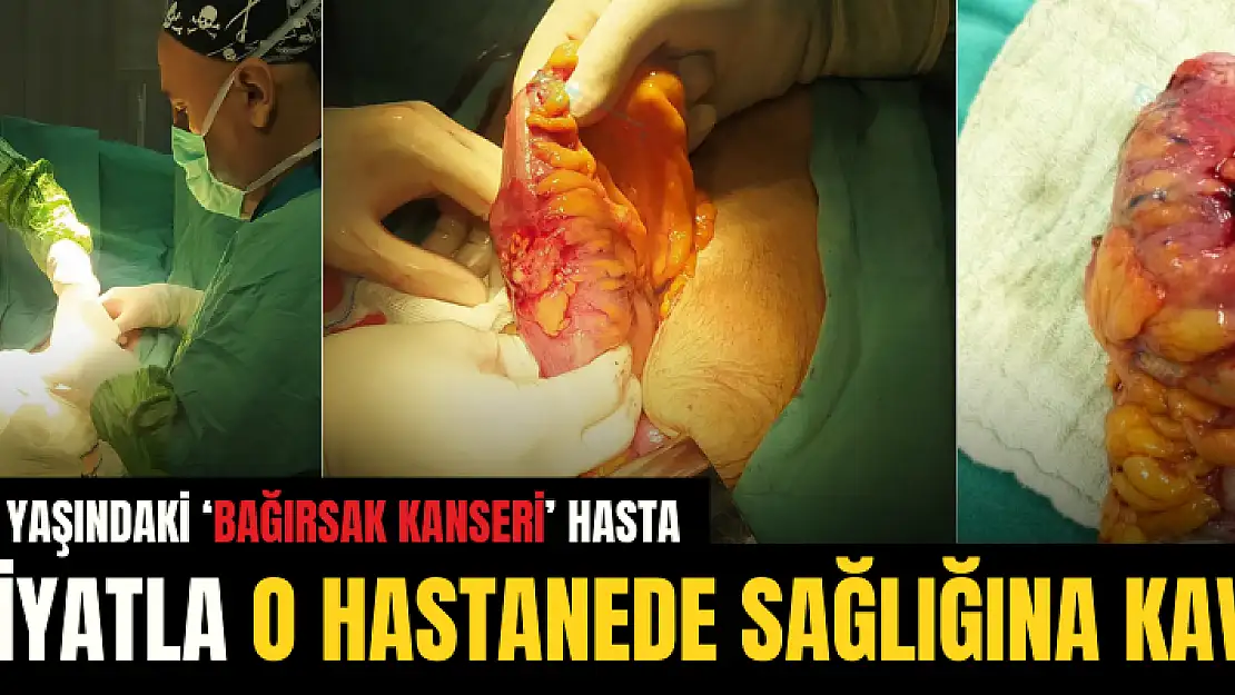 Siirt'te 84 Yaşındaki 'Bağırsak Kanseri' Kadın, Ameliyatla Sağlığına Kavuştu