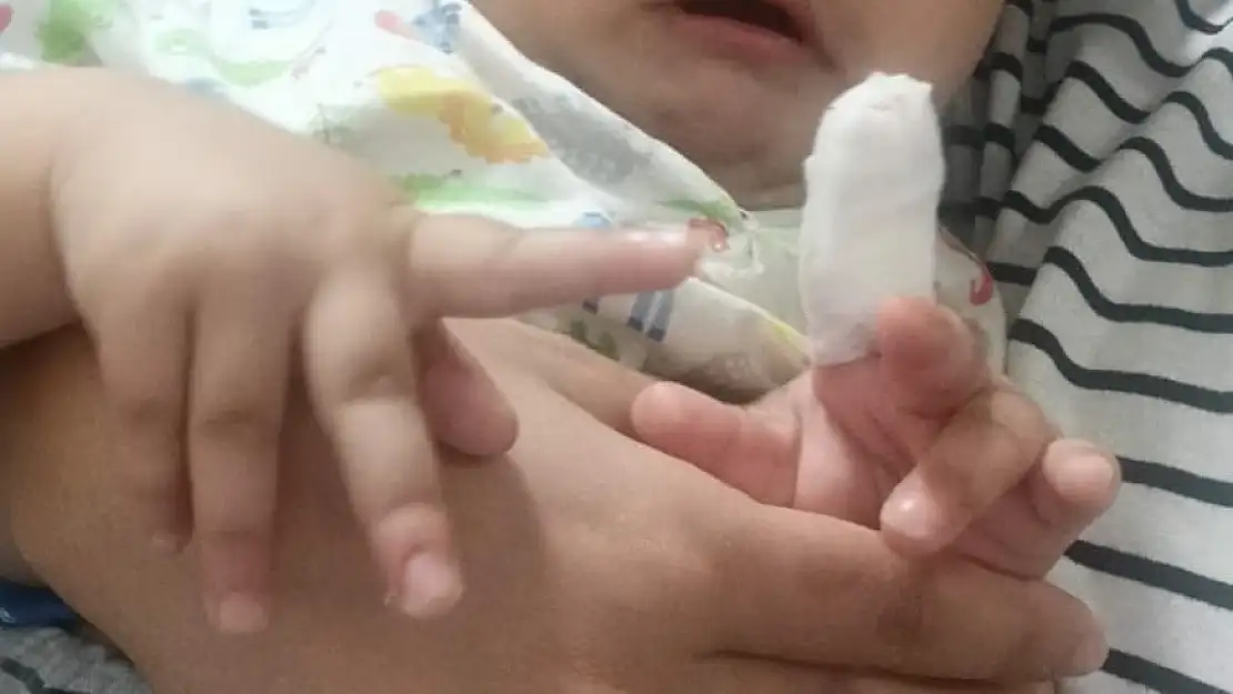 SİLOPİ'DE PARMAĞI KOPAN 2 YAŞINDAKİ ROZA, 4 HASTANE, 2 İL DOLAŞTI!