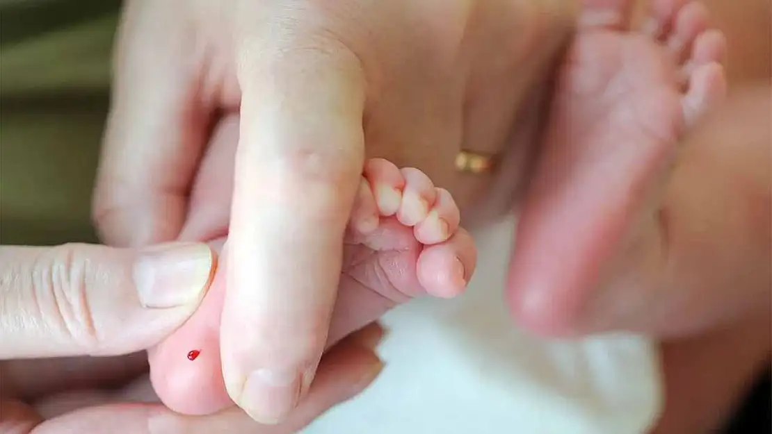 Türkiye'de Fenilketonüri Taşıyıcılığı Yaygın: Erken Tanı Hayat Kurtarıyor
