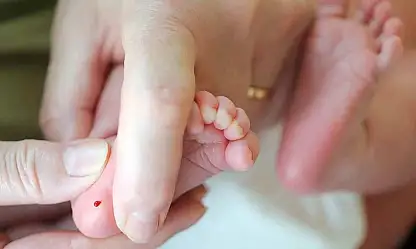 Türkiye'de Fenilketonüri Taşıyıcılığı Yaygın: Erken Tanı Hayat Kurtarıyor