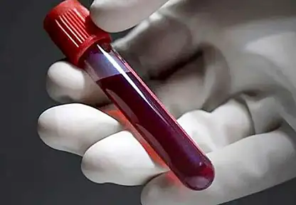 Bilimsel Araştırmalar Açıkladı: En Sağlıklı Kan Grubu Hangisi?