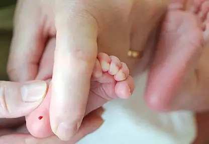 Türkiye'de Fenilketonüri Taşıyıcılığı Yaygın: Erken Tanı Hayat Kurtarıyor