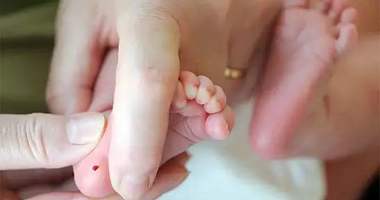 Türkiye'de Fenilketonüri Taşıyıcılığı Yaygın: Erken Tanı Hayat Kurtarıyor