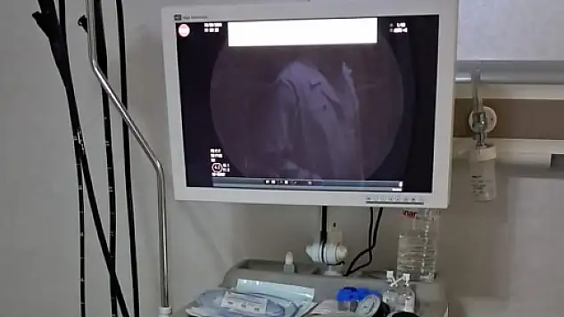 Teknolojide Son Sistem Endoskopi ve Kolonoskopi Cihazı Siirt Hayat Hastanesinde